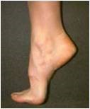 Dorsiflexion